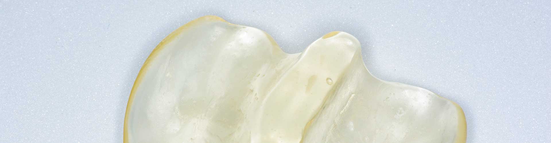 Wie Kurz Kann Eine Gaumenplatte Gemacht Werden Lippen-, Kiefer- Gaumenspalten | Kieferorthopädie Bremen